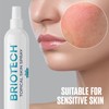 BRIOTECH BRIOTECH Topical Skin Spray, Hypochlorous Acid Spray for Body