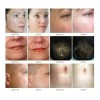 E-karly Derma Roller Facial Barba 0.5 Mm Titanio Regenera +
