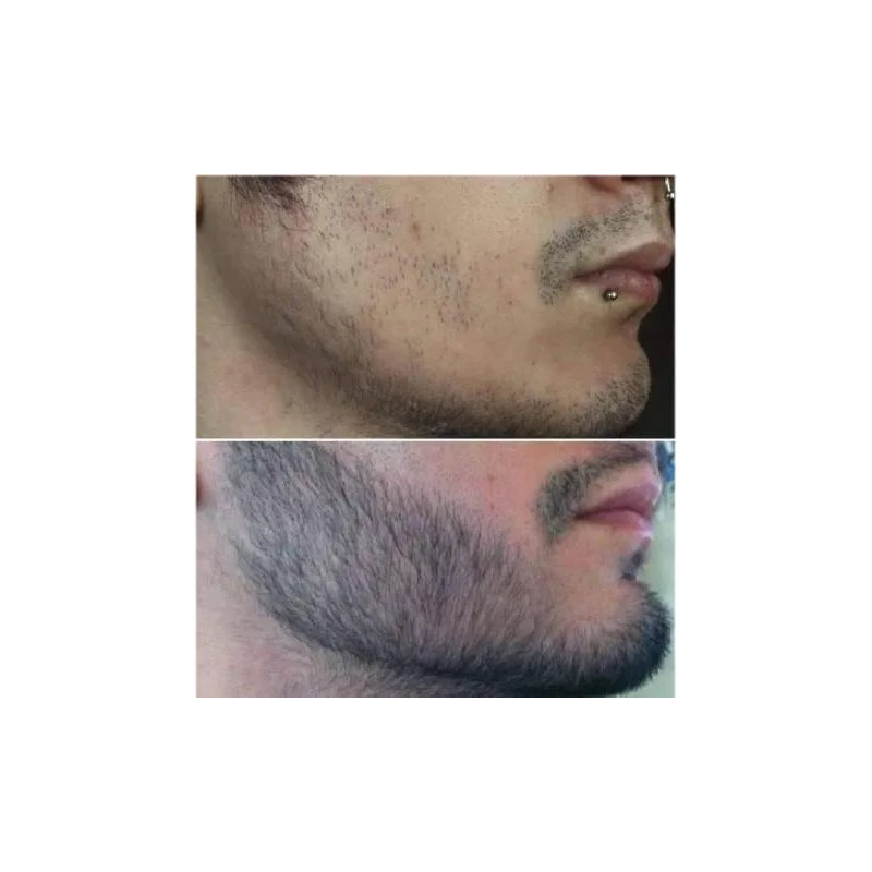 Crecer Barba Bigote Cejas Profesional Y Natural Total