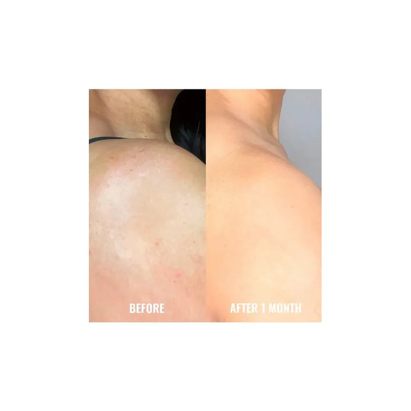 Suero Corrector De Manchas Para Cuerpo Good Molecules 120 Ml