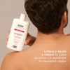 ISDIN Lambdapil, Shampoo Anticaída, Ayuda a Reducir la Caída del