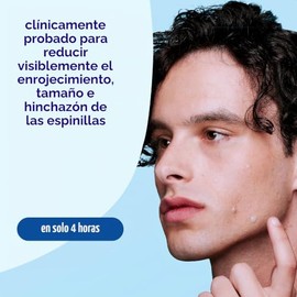Limpiador exfoliante Advantage Clean & Clear, Tratamiento localizado para acné, paquete de de 1