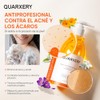Quarxery Gel Ducha Antiácaros Body Wash Eliminación Profunda Ácaros Acné