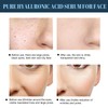 Face Lifting, Collagen Silk Threads, Collagen Silk Threads for Lifting,