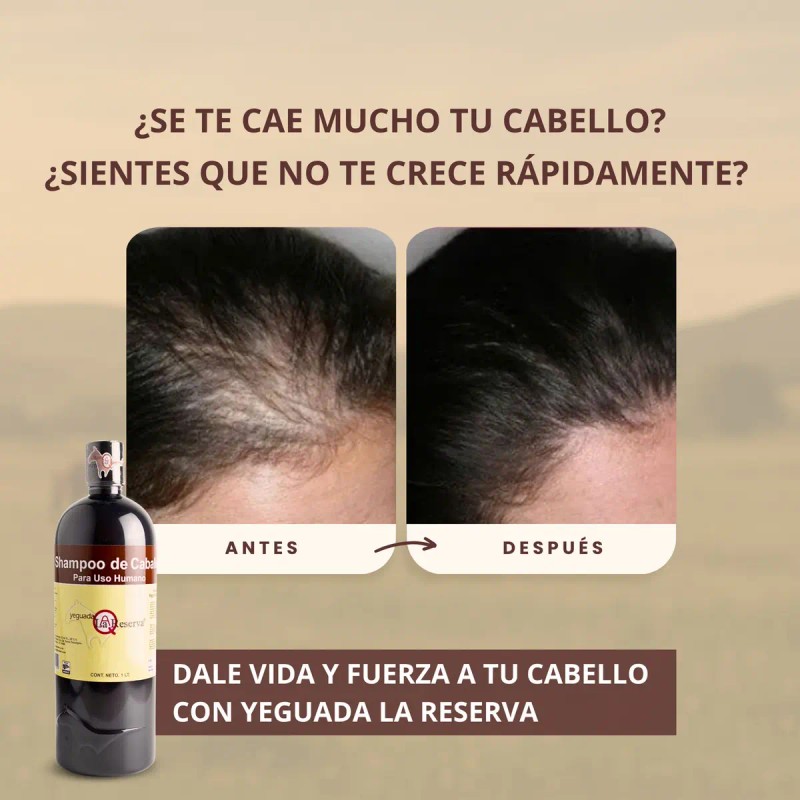 Kit Completo Shampoo Yeguada Reserva Colageno Chico Express