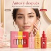 Kit de Sérums Faciales Antiedad e Hidratante, Set de 3
