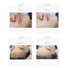 (Domestic) Siarte Sugar Waxing Self-Waxing Set Brazilian Underarm Arm Leg,