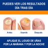 Para Eliminar Hongos En Uñas De Manos Y Piessolución, 30ml