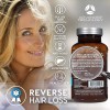 Advanced Trichology FoliGROWTH™ Hair Growth Supplement for Thicker Fuller Hair
