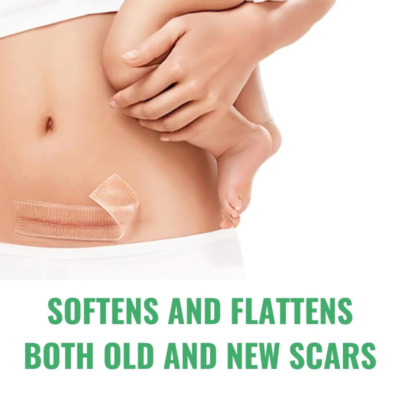 NIEGON Professional Silicone Scar Tape (1.6" x 60") - Scar