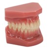 Tooth Model 28 Teeth Dental Orthodontic Model Teaching Study Supplies