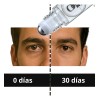 Roll On Anti Ojeras Oscuras Anti Bolsas Inflamadas Om Style