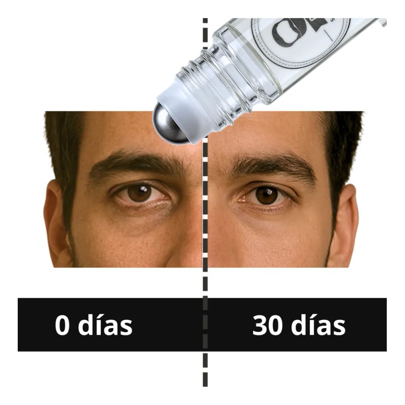 Roll On Anti Ojeras Oscuras Anti Bolsas Inflamadas Om Style