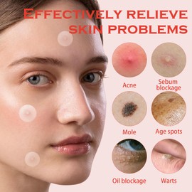 CHAOTEMAI Pickel Patches Tag- und Nachtgebrauch Hydrocolloid Patches Mini Pimple Patch Wasserfest und Schweißfest für Normale Trockene Fettige Haut Geschäftsreisen Reisen (2 Schachtel)