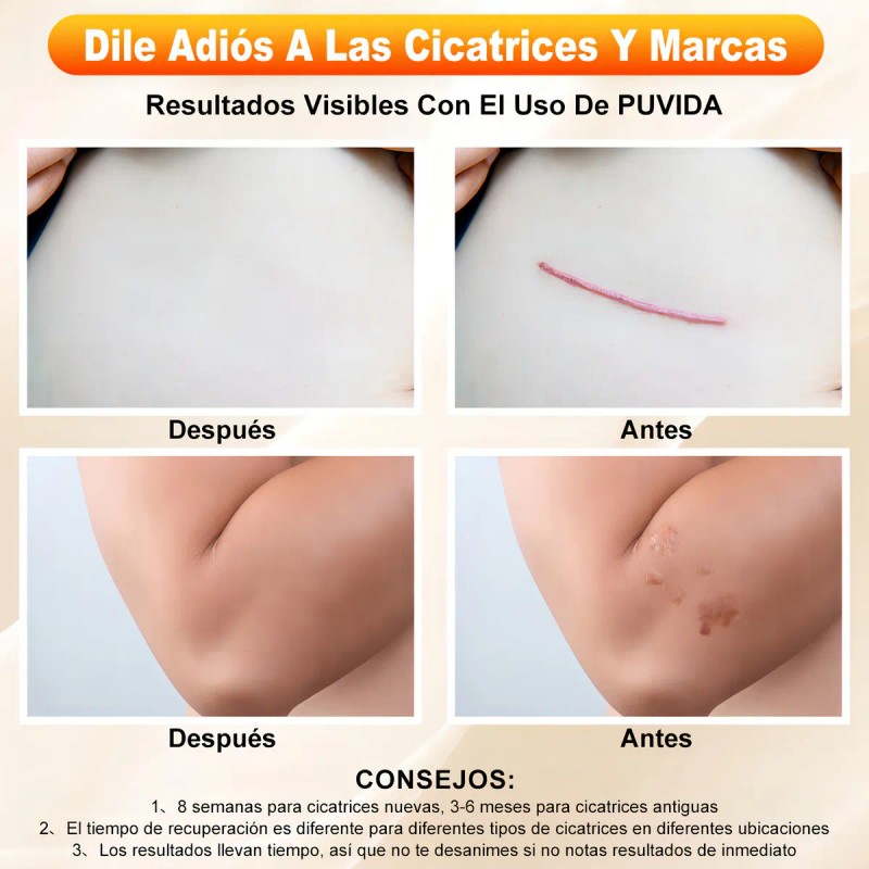 Crema Eliminar Cicatrices Gel Depara Reparar