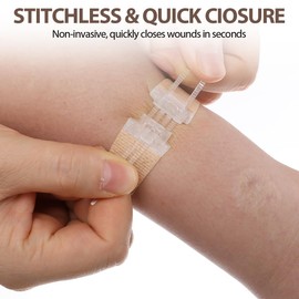 Wound Closure Strips Emergency Laceration Closures 5Pcs Butterfly Stitches Sutures Bandaids Zip Stitch Without Stitches for Hiking Camping Survival Outdoor