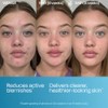 Murad Biome-Balancing Serum - Suero Facial Anti-Imperfecciones con Ácido Salicílico,