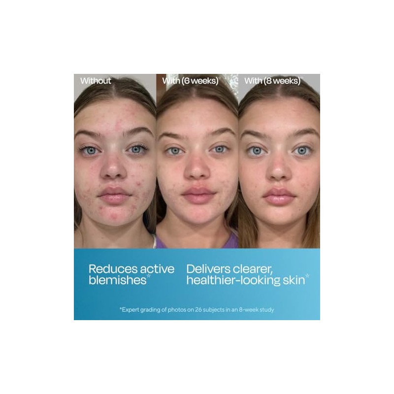 Murad Biome-Balancing Serum - Suero Facial Anti-Imperfecciones con Ácido Salicílico,