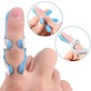 Solace Care Finger Immobilising Splint with Soft Foam - Ideal
