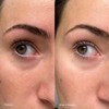 Topicals Máscaras de brilho desbotado para os olhos Remendos para