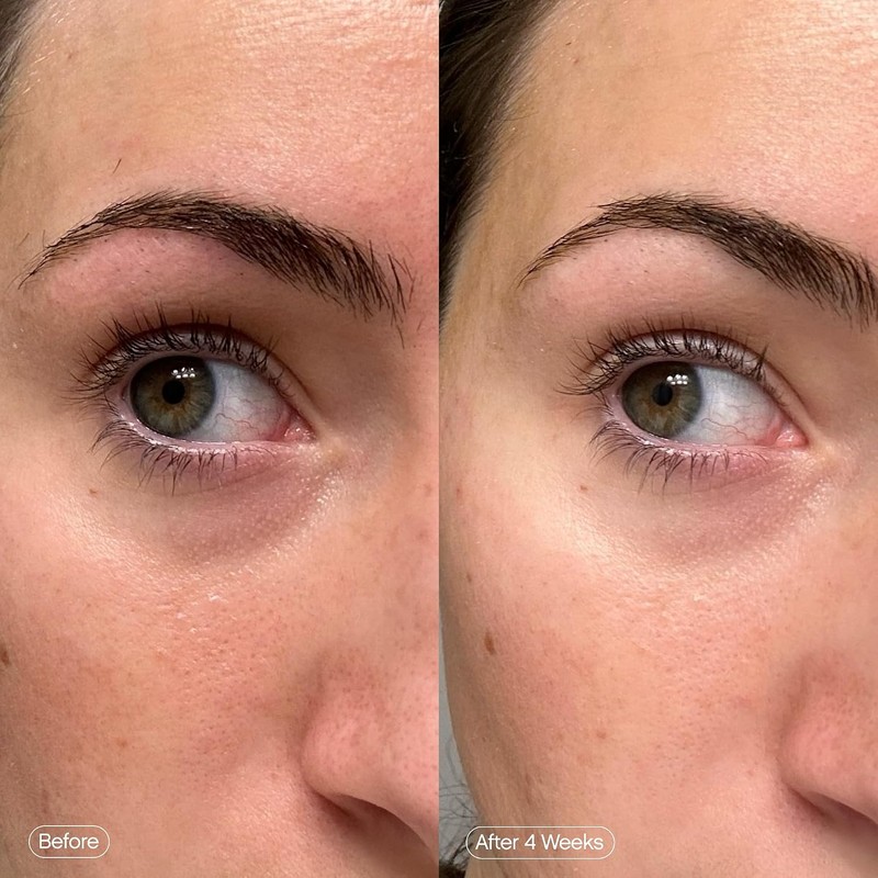 Topicals Máscaras de brilho desbotado para os olhos Remendos para