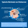 Evolsin anti-stem wart