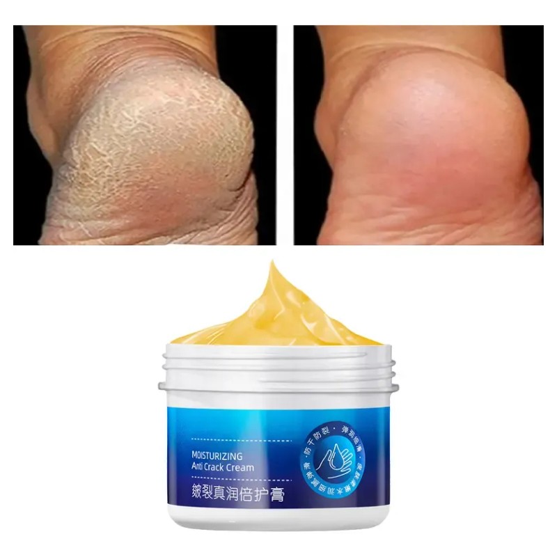 Crema Antisequedad Para Reparar Las Grietas De Los Pies Y