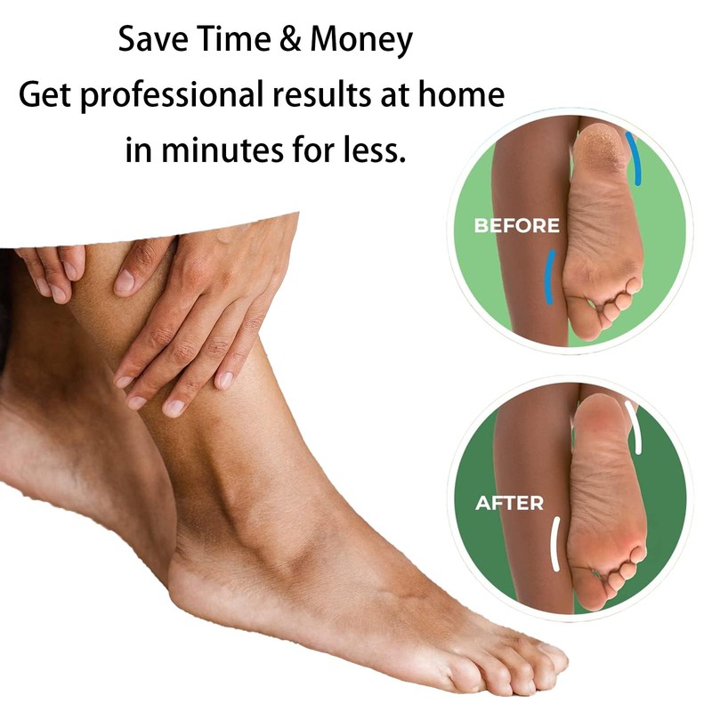 4 Foot Teplacement Rollers for Effective Foot Care, Exfoliating and