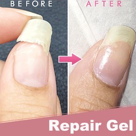 Nagelreparatur-Schutzgel Set für Brüchige Naturnägel - Schneller Nagelkleber & Reparaturgel, Nagelhärter & Nagelverstärker, Aufbaugel für Nagelverlängerung, Instant Easy Quick Fix gebrochene Nägel