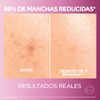 L'ORÉAL PARIS SKIN Kit anti-manchas Glycolic Bright: Sérum 30ml +