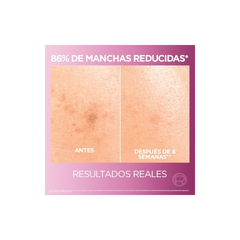 L'ORÉAL PARIS SKIN Kit anti-manchas Glycolic Bright: Sérum 30ml +