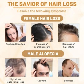 Sérum Capilar Douniu Con Agua De Arroz Para El Crecimiento D