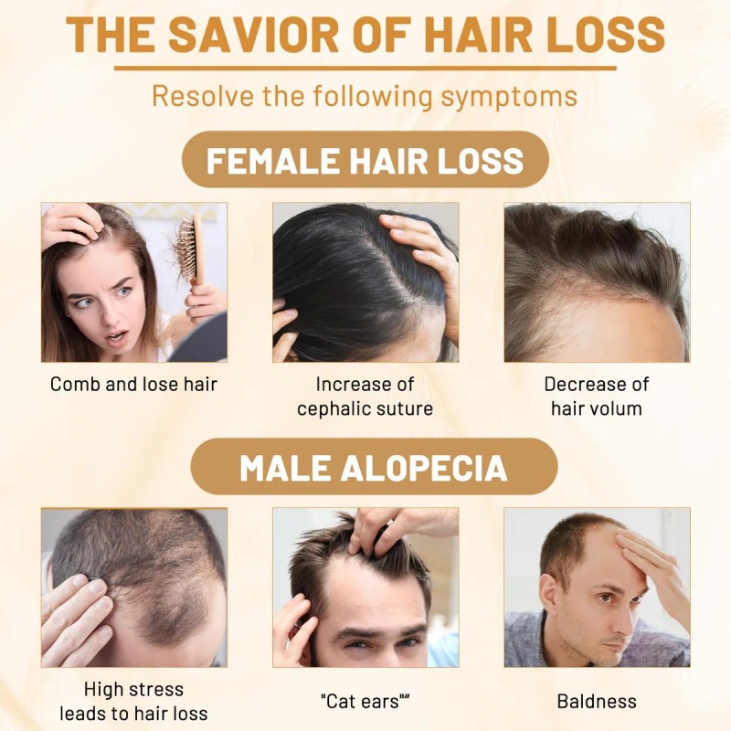 Sérum Capilar Douniu Con Agua De Arroz Para El Crecimiento