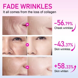 EHIOG 100g Schnecken-Kollagencreme – Anti-Aging Feuchtigkeitscreme mit Rekombiniertem Kollagen, Glättet Falten & Strafft die Haut – Gesichtscreme für Männer & Frauen