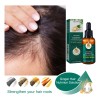 Aceite Esencial De Jengibre Para El Cuidado Del Cabello: Par