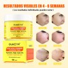 Aclarante Manchas Poros Acné Grasa Pads Cúrcuma Kójico 50pz