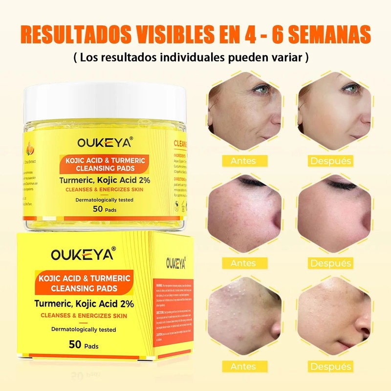 Aclarante Manchas Poros Acné Grasa Pads Cúrcuma Kójico 50pz
