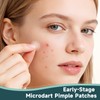 Microdart Pimple Patches for Face 9 Count,Hydrocolloid Zit Acne Patches