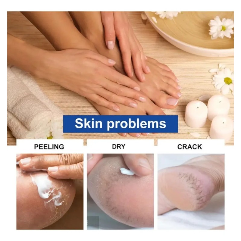 Crema Para Pies Con 45 % De Urea Y 2