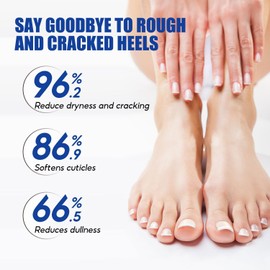 60% Urea Foot Cream for Cracked Heels and Dry Skin, Urea Cream 60 Percent for Feet, Cracked Heel Repair Creams, 100ml