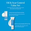 Murad Oil & Scar Control Value Set - 2-Piece Full-Size