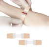 Zip Stitch Laceration Repair Without Stitches Butterfly Bandaids Quick Clot
