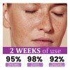 Highly Effective Anti-pigmentation Serum Whitening Blemish R