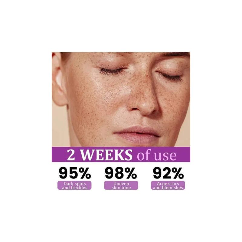 Highly Effective Anti-pigmentation Serum Whitening Blemish R