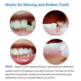 Healthyare Tooth Repair Kit, Moldable False Teeth Thermal Fitting Beads,Temporary Filling Broken Teeth Gap for Snap On Instant and Confident Smile, Denture Adhesive
