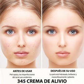 SINYI 345 Relief Cream, crema reparadora intensiva, hidratante y humectante, crema suave y calmante, adecuada para todo tipo de piel (1pcs)