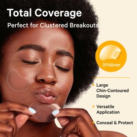 Sosky Chin Hydrocolloid Pimple Patches 12 Counts