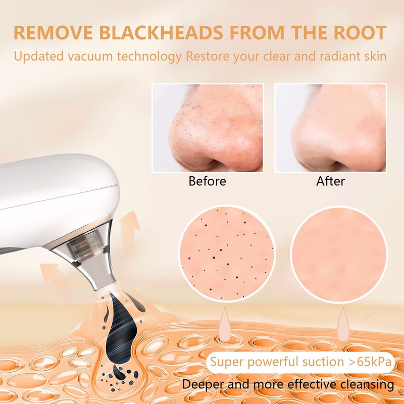 tlidfgeo Mitesserentferner Porenreiniger Porensauger, Porensauger Gesicht Pickelsauger Mitesser Sauger Elektrisch