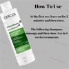 Vichy Dercos Shampoo 200ML, Vichy Dercos Aminexil, Anti Dandruff Hair