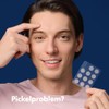 Mighty Patch Original Hero Cosmetics Pimple Patches, Small Hydrocolloid Patches,